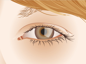 Augenenklinik Bellevue - vector illustration + animation // 4 images